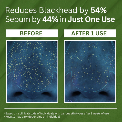 NIWOMAN - Holy Basil Bubble Deep Mask™