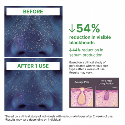 Ganic™ - Holy Basil Bubble Deep Mask